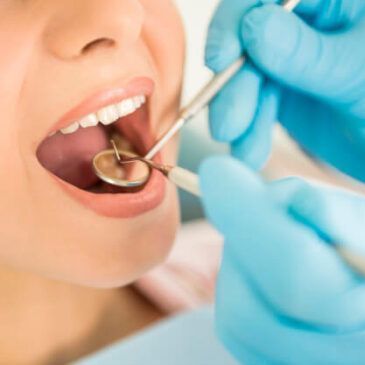 implante dentario
